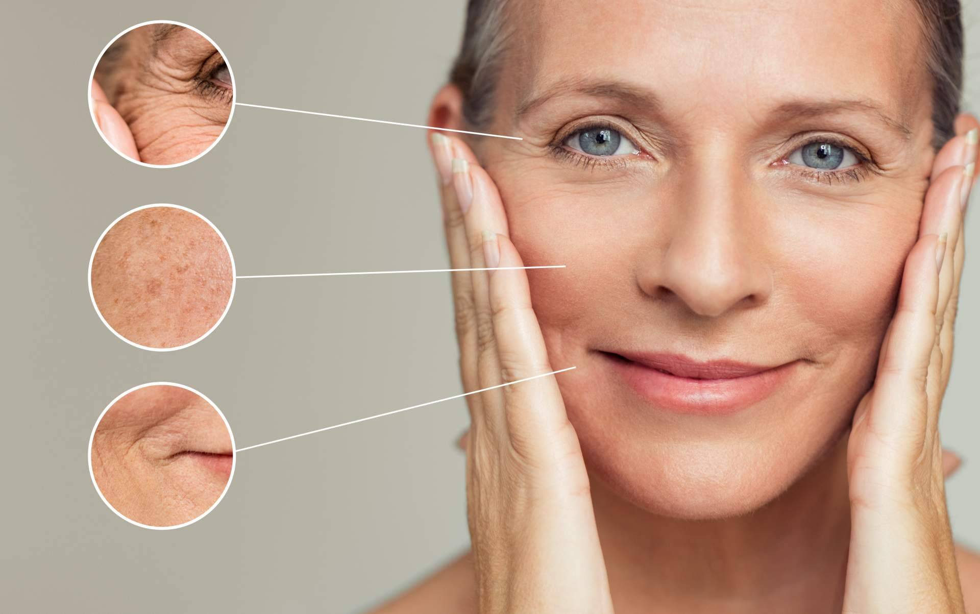  Las arrugas, un signo de envejecimiento de la piel que se puede frenar con los productos del Laboratorio Géomer 