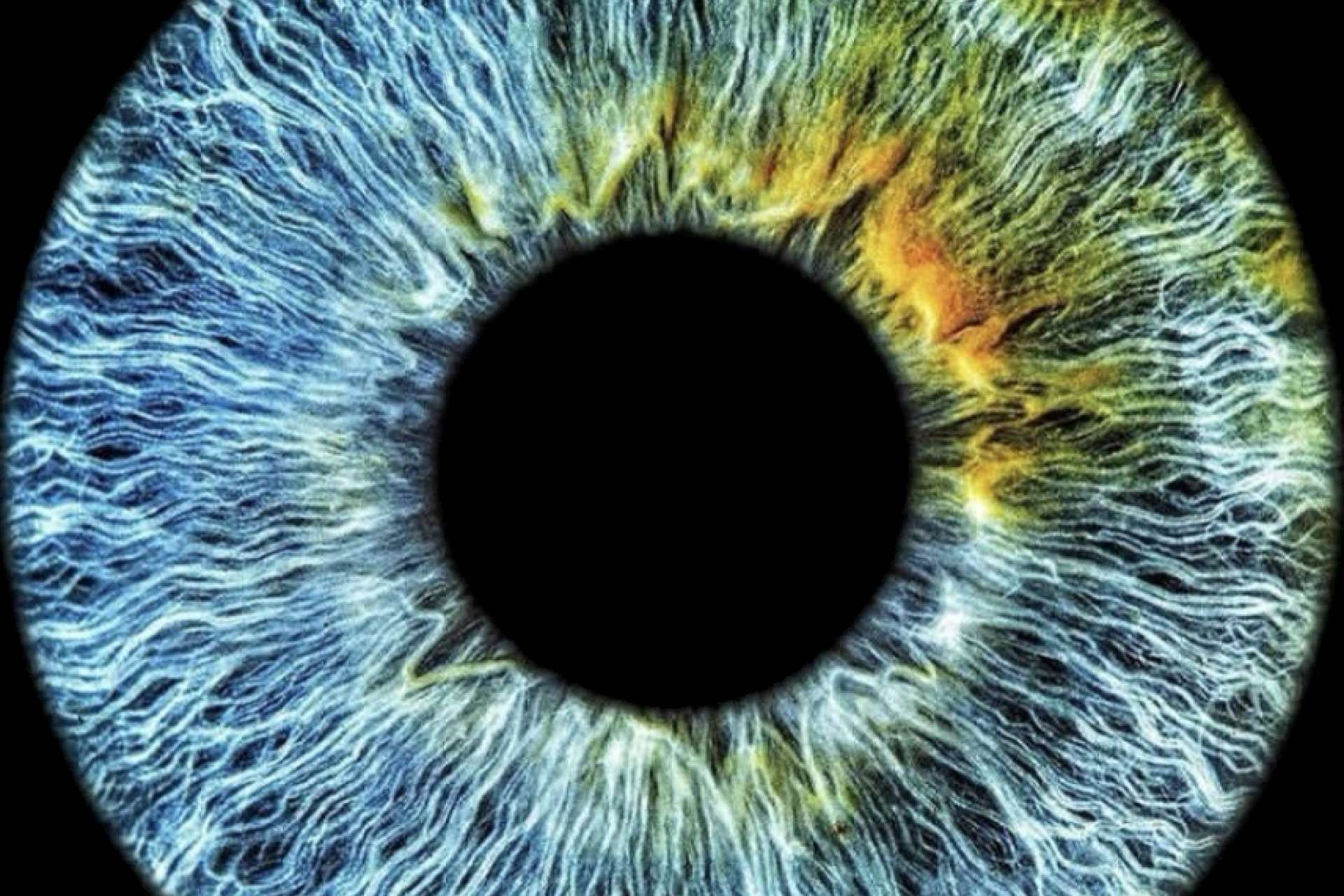  ¿Cómo influye la genética en el color de los ojos? Por EyeCos 