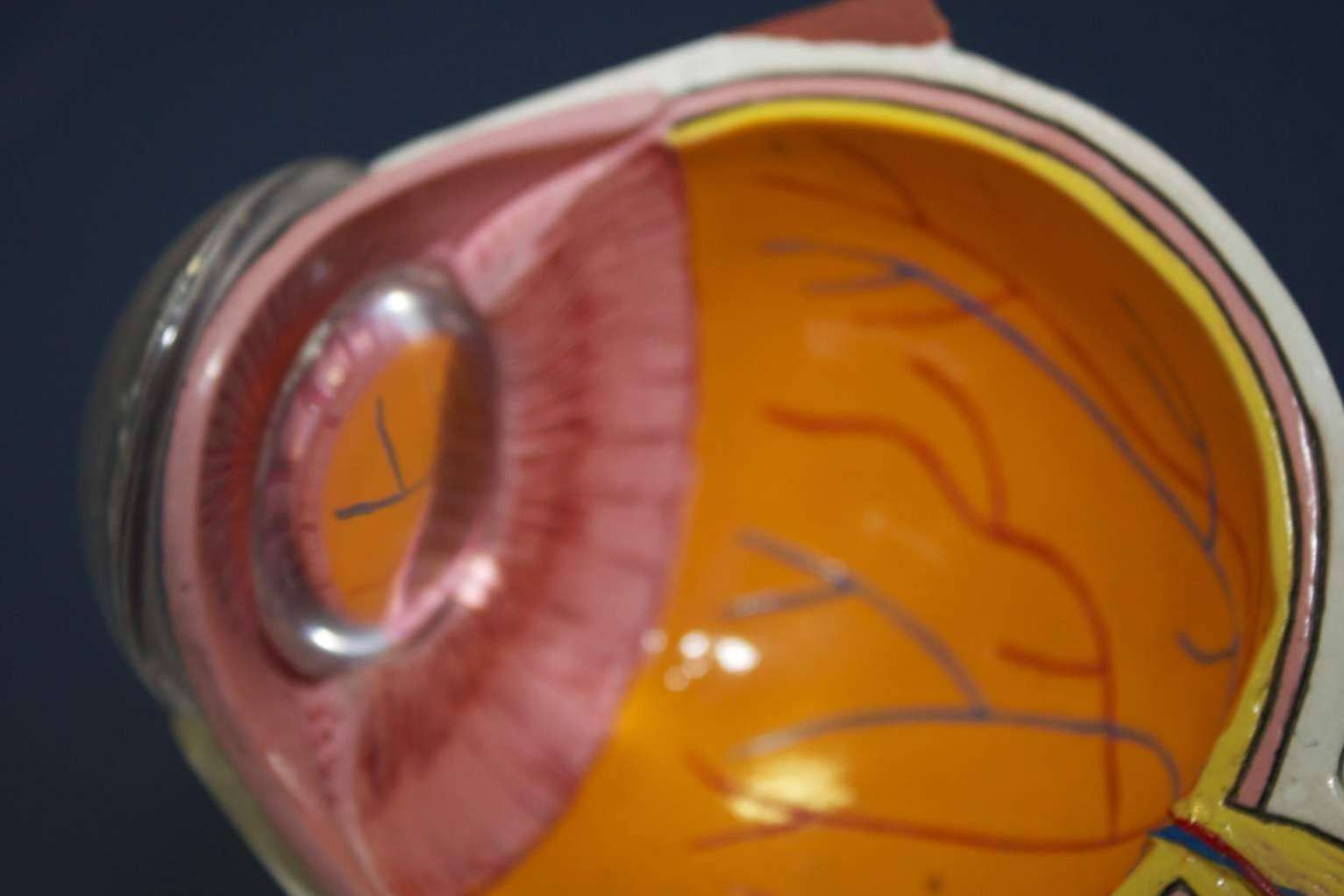  IOTT cuenta con tratamientos innovadores para casos de vista cansada, presbicia y cataratas 