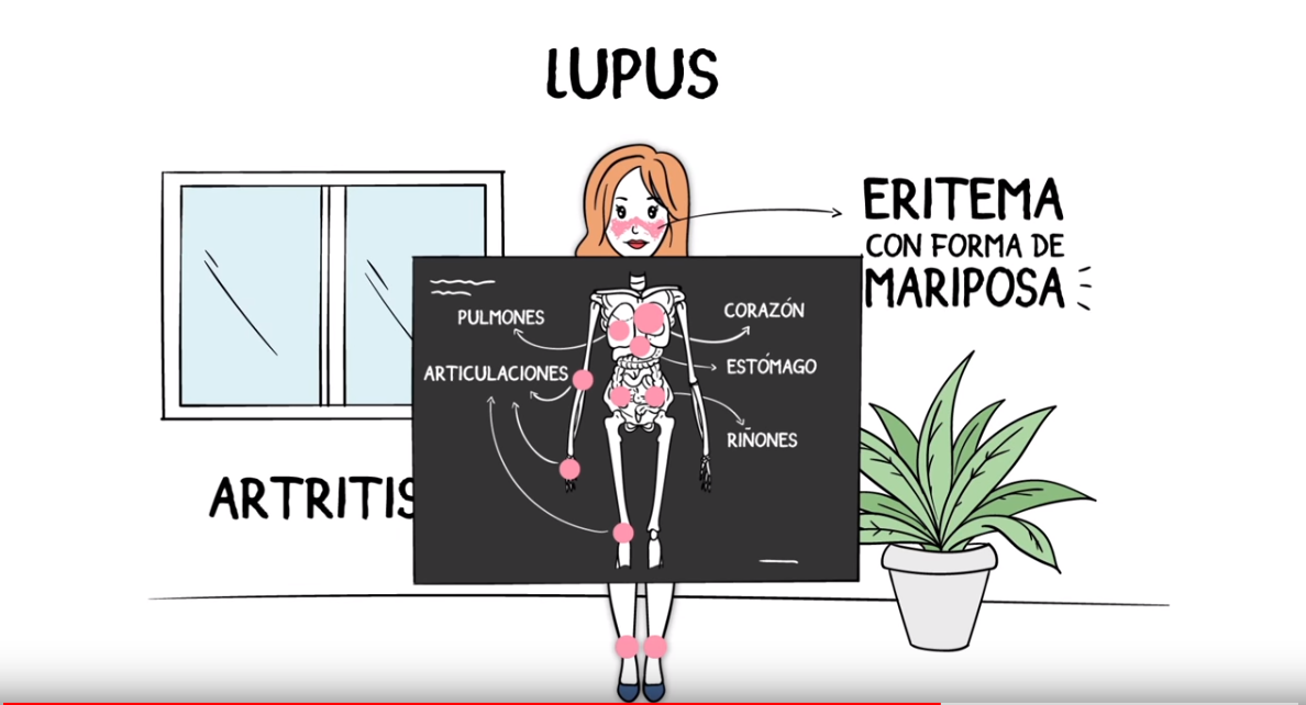 Pantallazo video lupus