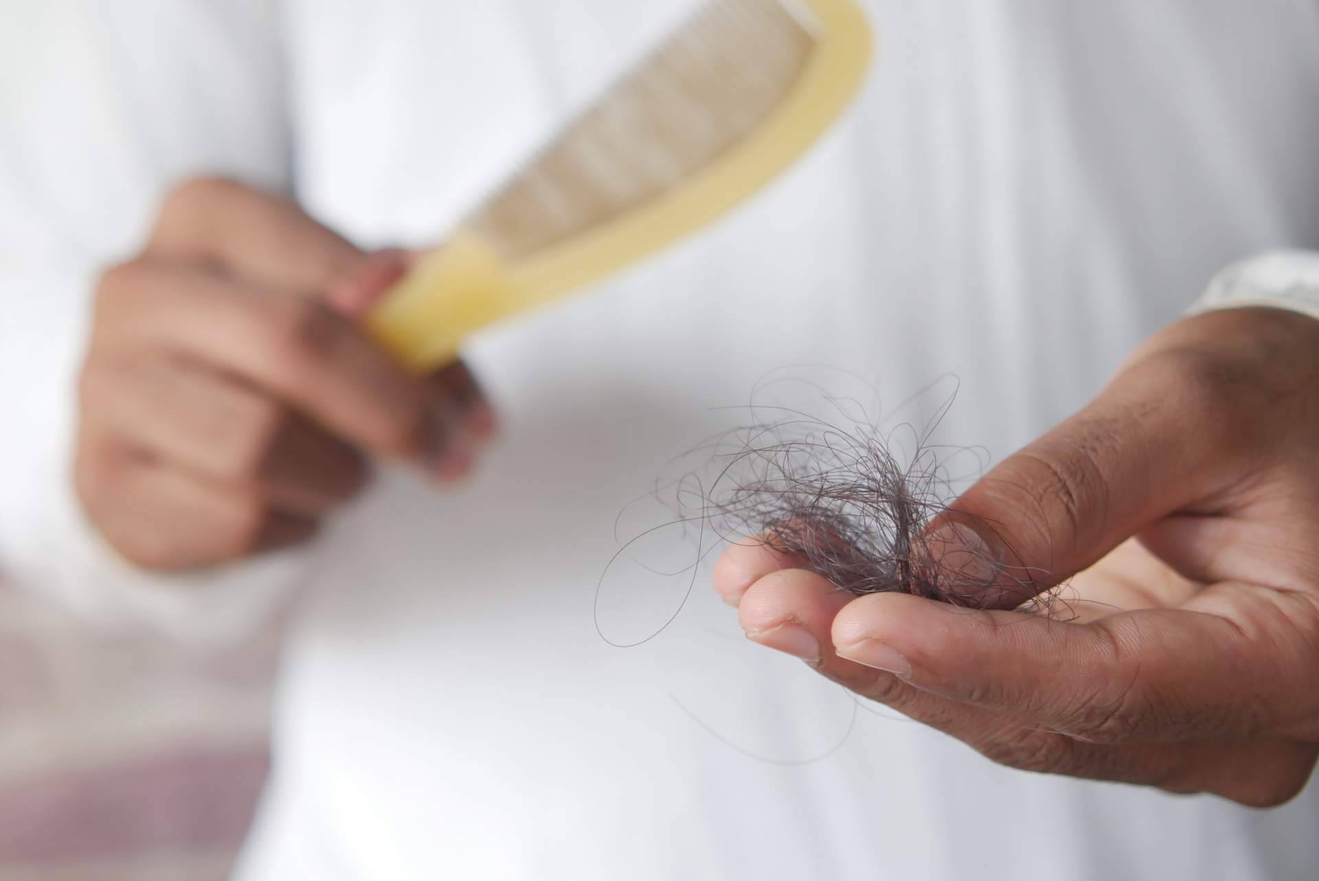 Tricólogos y especialistas capilares alertan sobre el aumento de enfermedades autoinmunes que provocan la caída del cabello